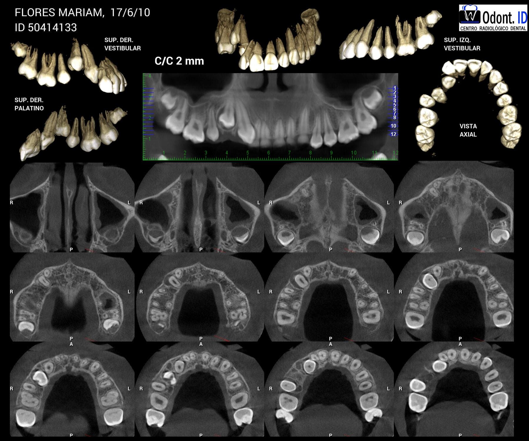 Información para pacientes
