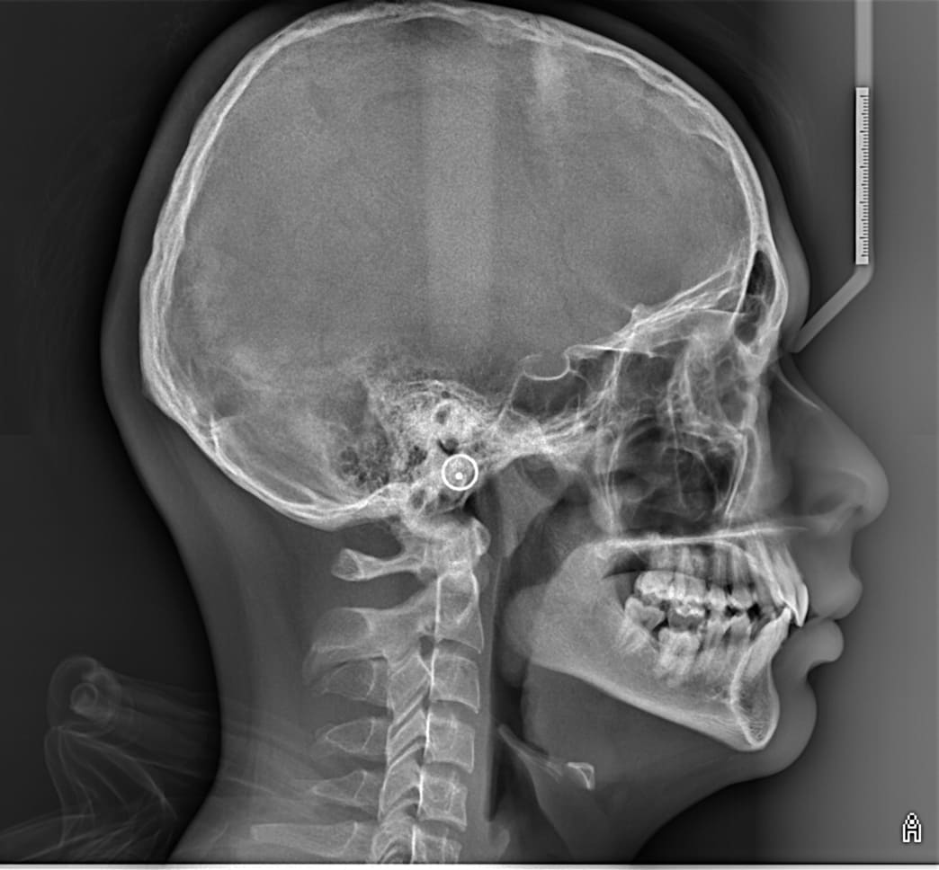 Radiografía Profesional